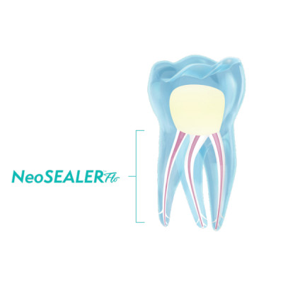 سیلر بایو سرامیکی  Neo Sealer آمریکا