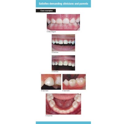 روکش زیر کونیا دندان های شیری تک عددی NuSmile آمریکا